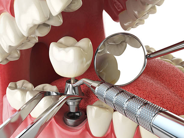Best Emergency Treatment for Oral Infections in Newcomerstown, OH